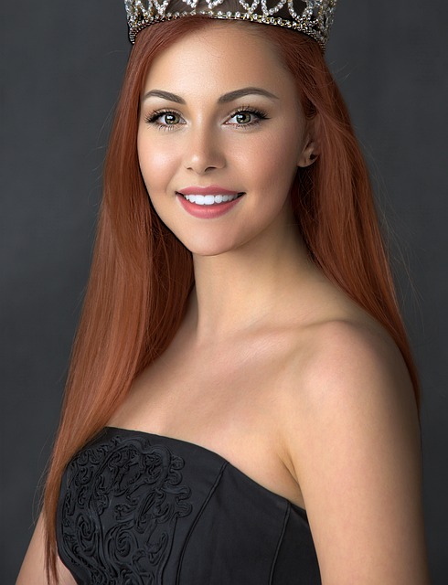 米德爾頓 米德爾頓